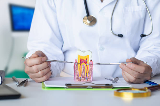 Best Emergency Wisdom Teeth Removal in Methuen Town, MA